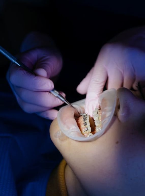 Children's Orthodontic Benefits