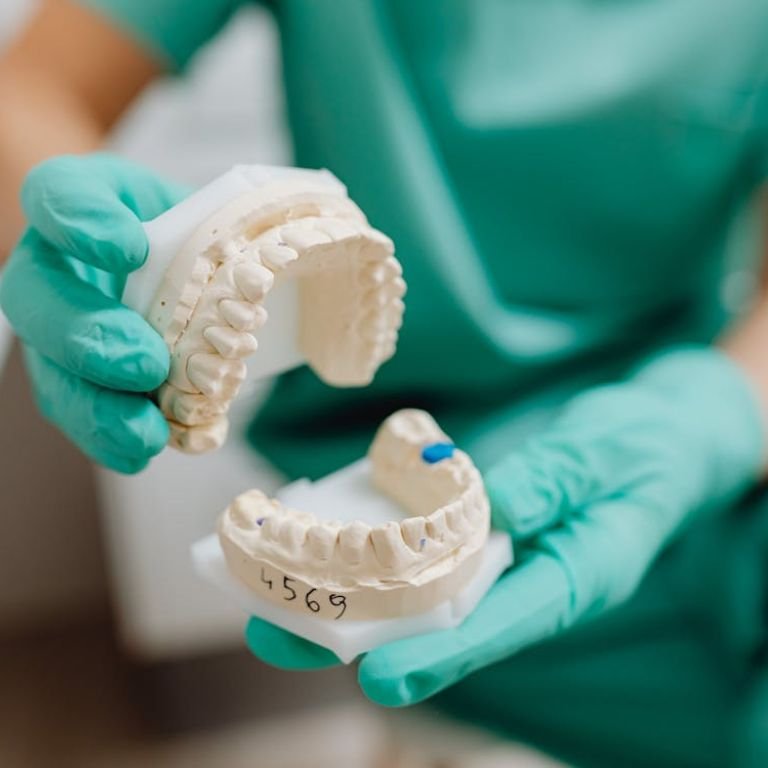 Smile Transformation Before and After