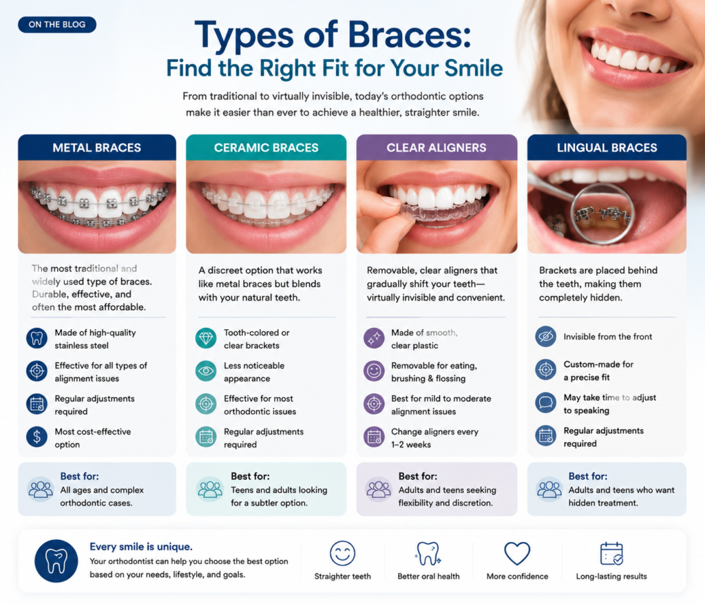 Comparison of metal braces, ceramic braces, Invisalign aligners, and lingual braces for orthodontics in Mossley
